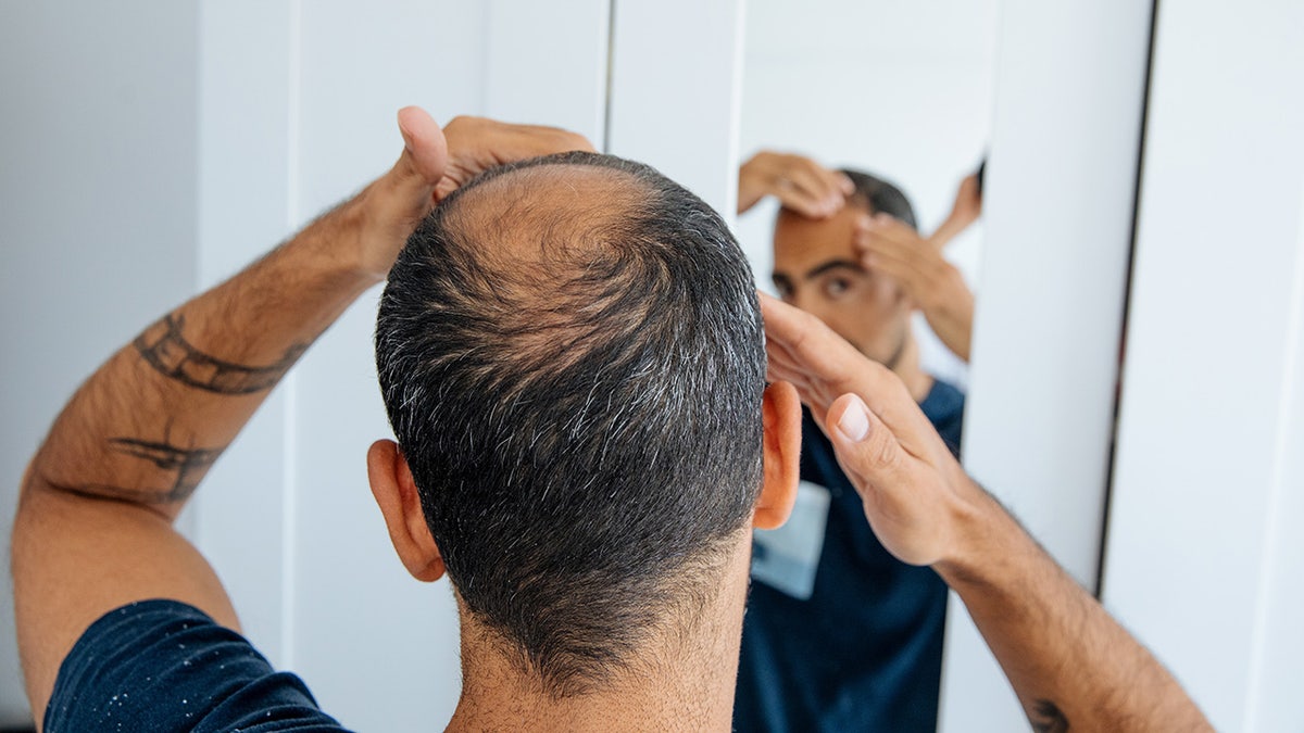 Bald man looking in the mirror at head